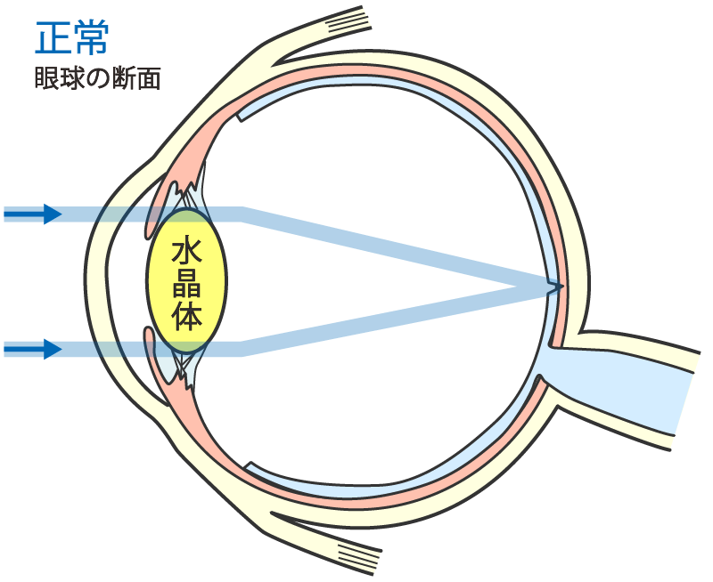 眼球の断面（正常）