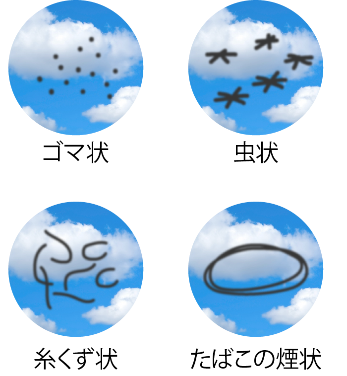飛蚊症とは