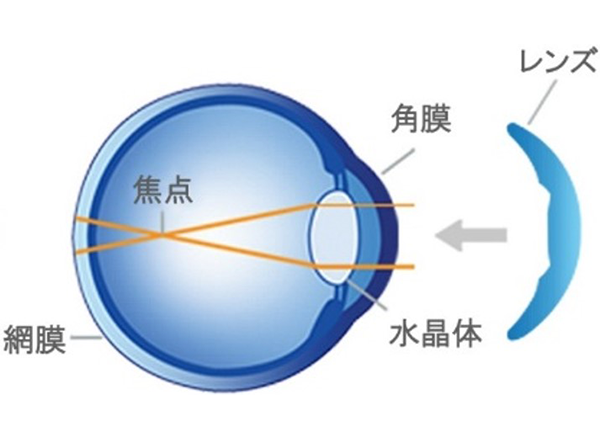 矯正前