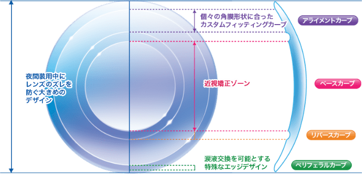 マイエメラルドのレンズデザイン